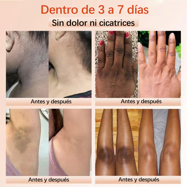 ⚡Venta flash⚡QUARXERY Exfoliante En Gel Suave