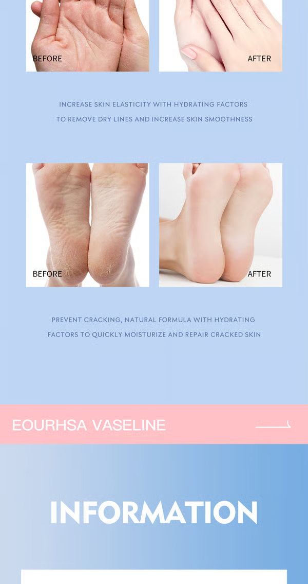 🔥🔥Compra 1 y llévate 4：Crema para el cuidado de los pies, crema antigrietas, crema hidratante, antigrietas, suavizante y nutritiva para pies secos y agrietados, elimina la piel muerta e hidrata la piel seca.