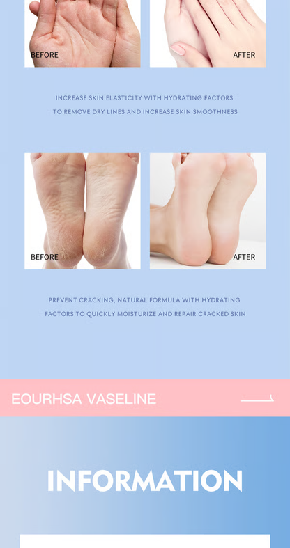 🔥🔥Compra 1 y llévate 4：Crema para el cuidado de los pies, crema antigrietas, crema hidratante, antigrietas, suavizante y nutritiva para pies secos y agrietados, elimina la piel muerta e hidrata la piel seca.