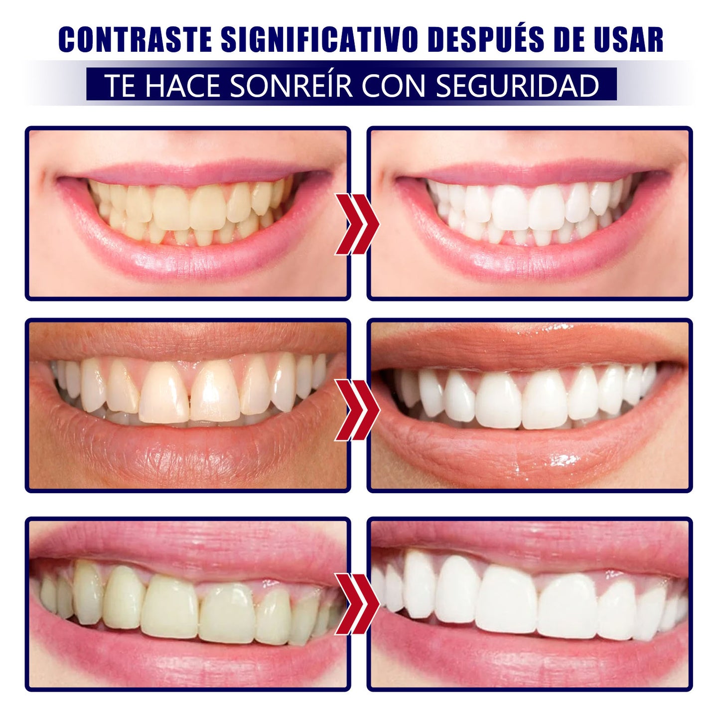 VELISHE - Tiras blanqueadoras de dientes rápidas de 30 minutos, suaves e inofensivas