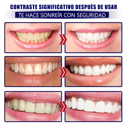 VELISHE - Tiras blanqueadoras de dientes rápidas de 30 minutos, suaves e inofensivas
